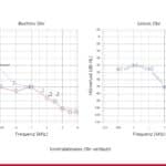 Maschinist mit hochgradiger Lärmschwerhörigkeit